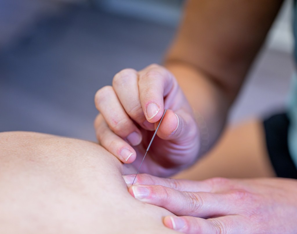 Dryneedling Levi - hieroja levi